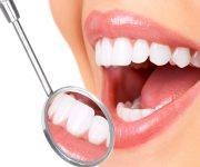 răng sứ heramic